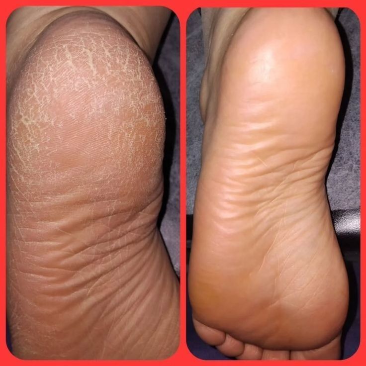 Pampering Pedicure at Shine De Spa, luxury spa in Ikeja Lagos